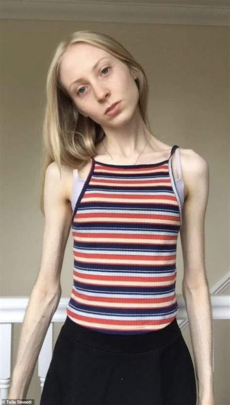 anorexic xxx|Anorexic